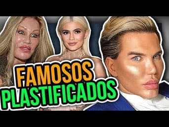 TOP 10 DA DIVA - Famosos plastificados feat. MANDY CANDY | Diva Depressão
